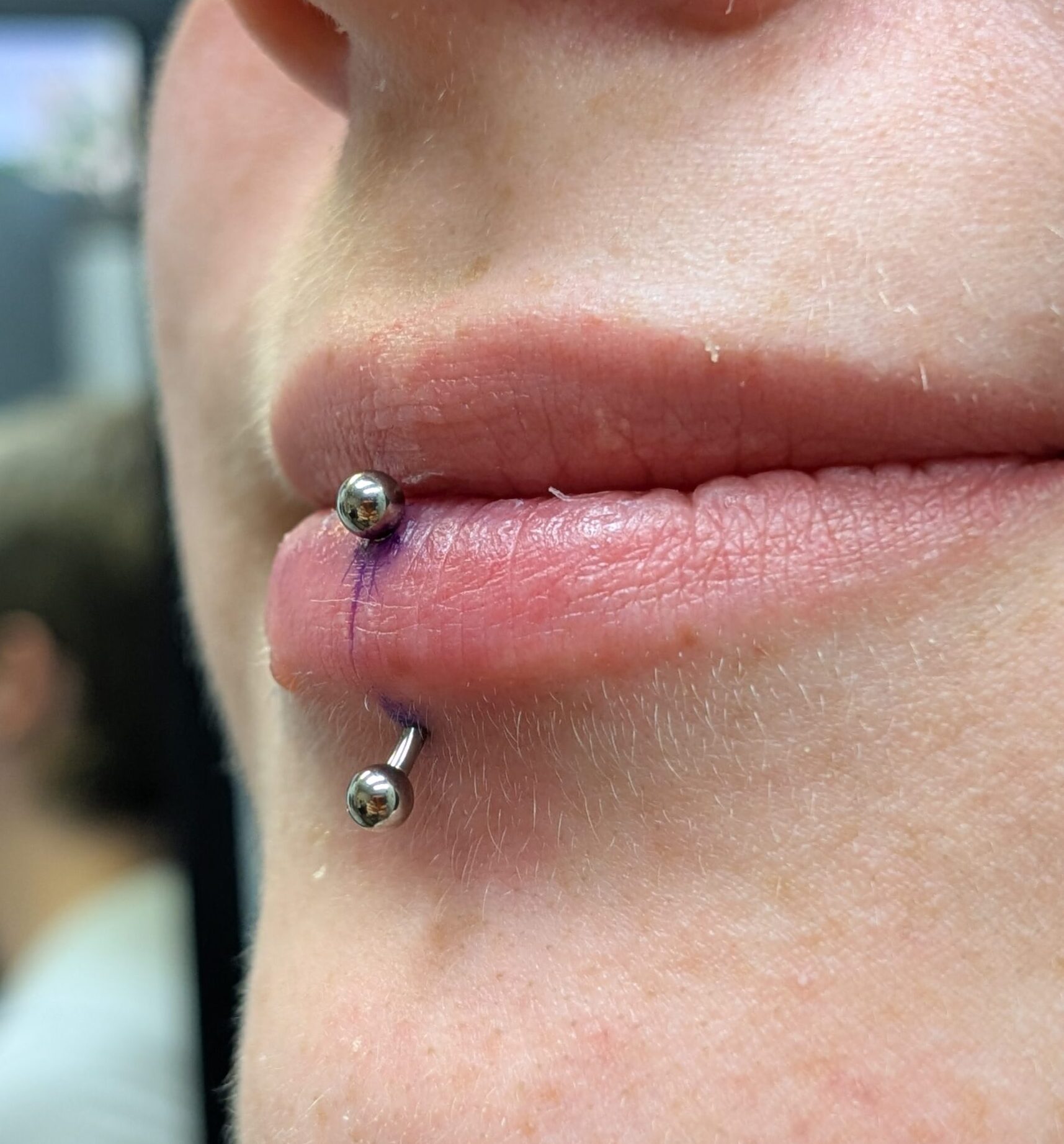 Vertical labret piercing in progress, showing placement below the lower lip.