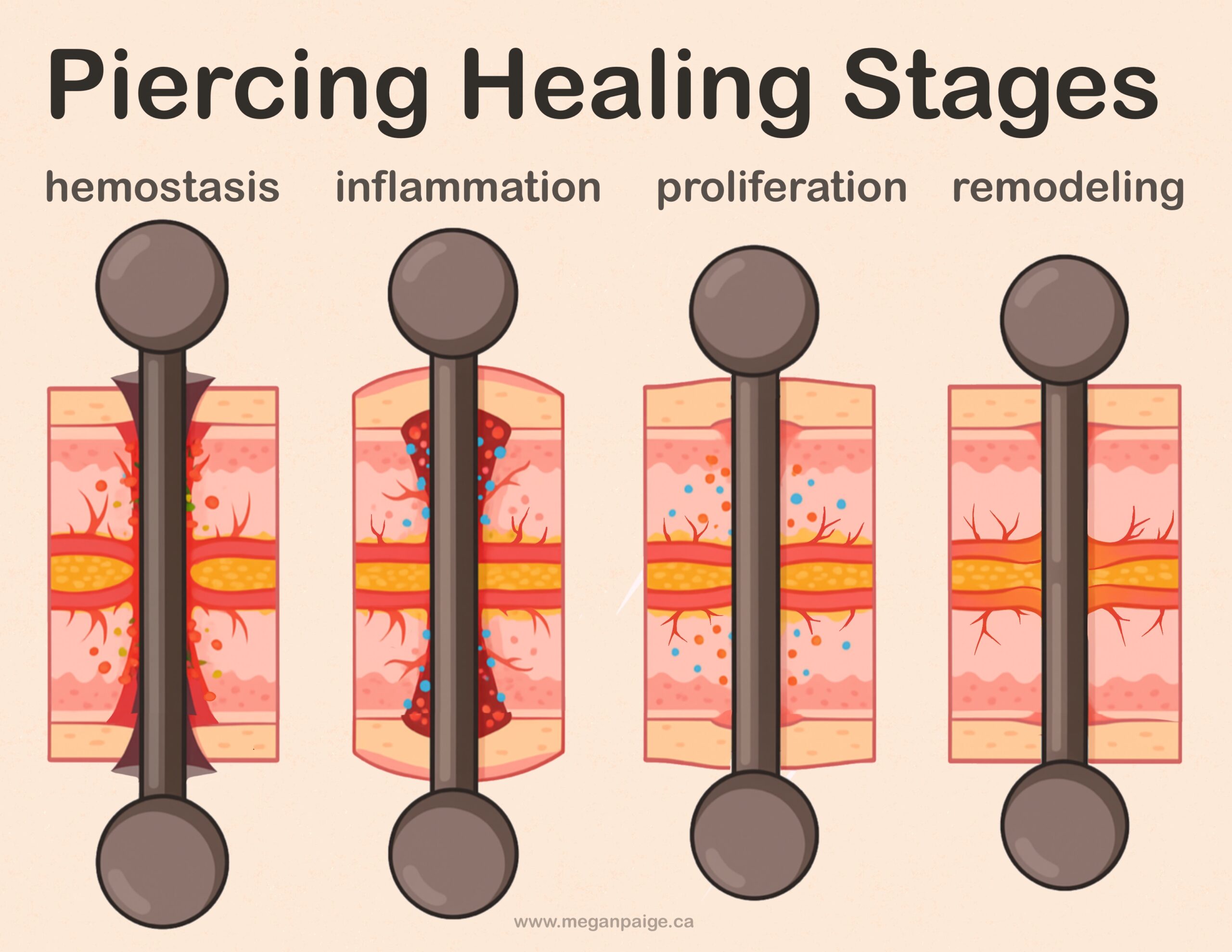 Illustration showing the stages of piercing healing from initial inflammation to full recovery.