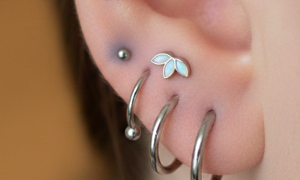 Sterling-Silver-Argyria-Skin-Staining