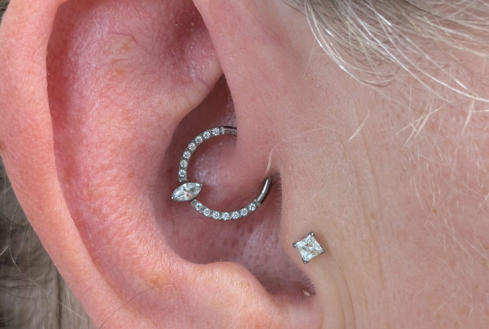 Healed daith piercing with a decorative clicker ring in a healthy ear.