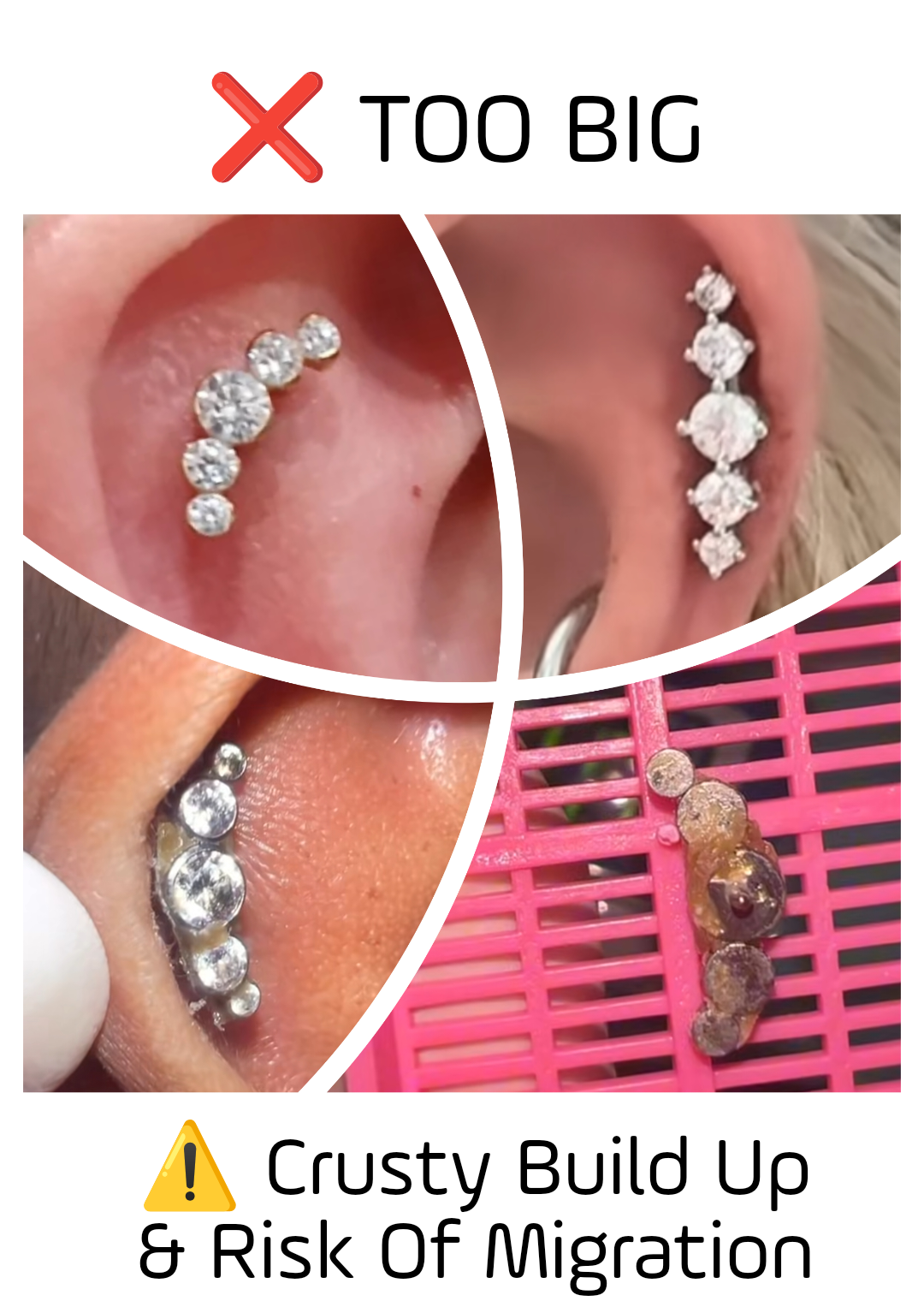 Two examples of oversized decorative gem clusters on fresh piercings, showing how the heavy jewelry sits flush against the skin with no room for cleaning.